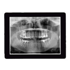 Digital X-Rays